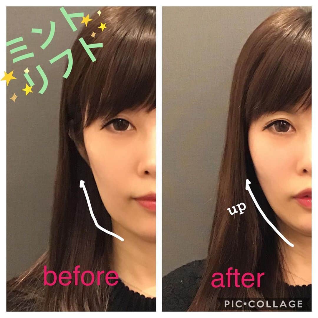 東京美容外科公式さんのインスタグラム写真 - (東京美容外科公式Instagram)「東京美容外科赤坂院です🙇🏻‍♀️ 本日は小顔やたるみに効果がある『ミントリフト』のご案内です。  ミントリフトは特殊な溶ける糸を皮下に埋め込むことでリフトアップ効果と美肌効果がある治療になります✨ 糸は徐々に溶けていきますが、加水分解される事でコラーゲンの生成が促されるため、今後のたるみ予防も期待できます❤️ 施術時間は1時間程度で、麻酔をする為、施術中はほとんど痛みを感じず施術頂けます😻 糸の施術は、1年に1回ほどのメンテナンスをお勧め致します。 エイジングキャンペーンの実施中ですので、お気軽にご相談下さいませ☺️ ===🎁お問い合わせはこちら🎁==== 詳しくはプロフィールのURLから公式サイトへ♪ ▼フリーダイヤル 0120-658-958 （コールセンター受付時間：9：00～21：00） ▼LINE予約 @ tkc110 #東京美容外科 #東京美容外科赤坂院 #赤坂 #港区#審美#セットバック#ルフォー#骨切り#美容 #美容整形 #きれい #整形 #美活 #綺麗になりたい #美肌 #美意識  #美容外科 #プチ整形 #韓国  #エイジングケア #アンチエイジング #美容好き #韓国美容 #美容整形外科 #二重 #埋没法」11月28日 18時57分 - tokyobiyougeka_jimukyoku