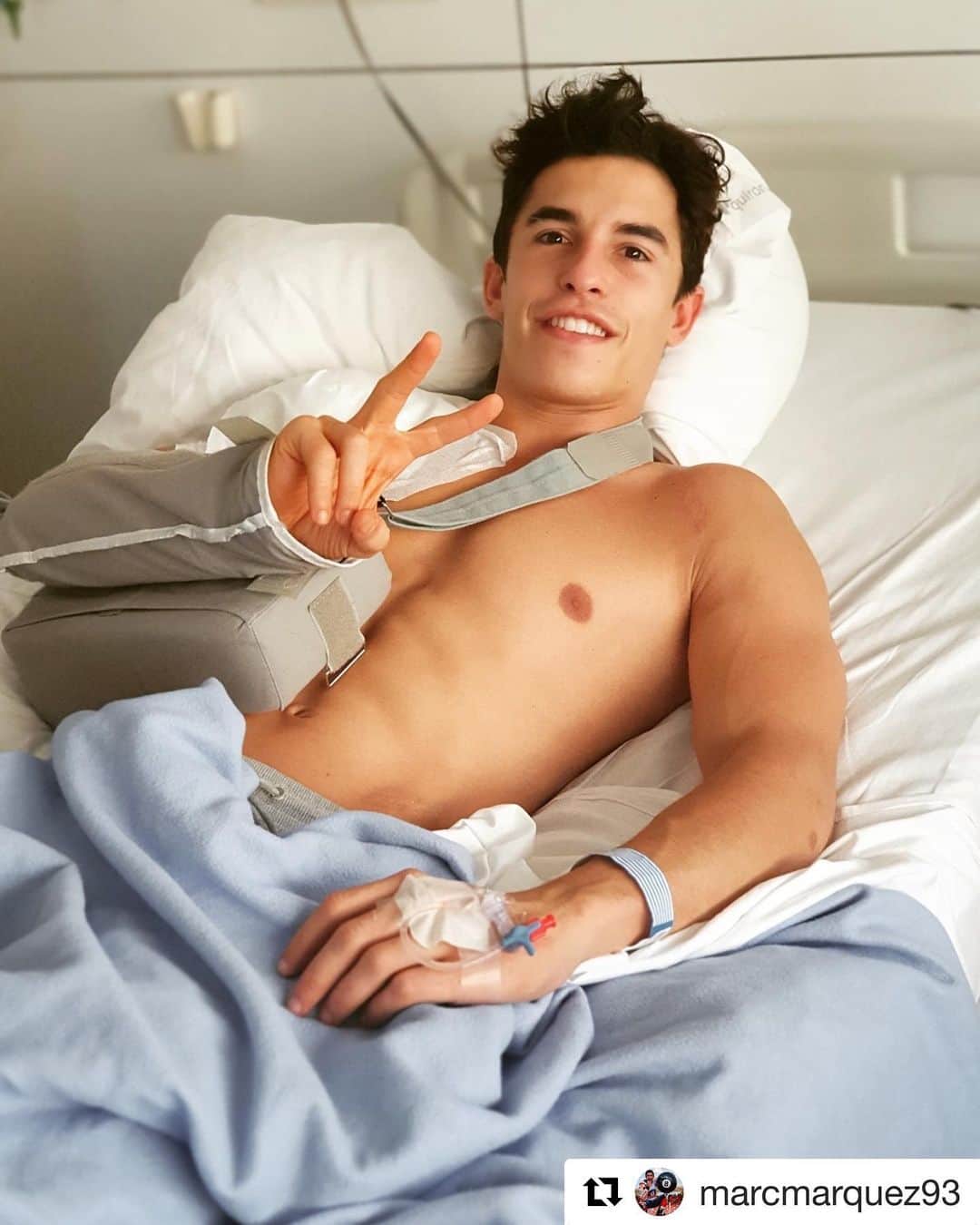 レプソル・ホンダのインスタグラム：「#Repost @marcmarquez93 ・・・ Buenos días a tod@s! Ya estoy más o menos despierto!😅 En la operación salió todo bien y ahora solo hay ganas de empezar la recuperación! Muchas gracias a todos por los mensajes de apoyo!💪🏼 Good morning! I’m more or less awake! 😅 The surgery went well and now I’m eager to start the recovery! Thanks for all your support messages!」