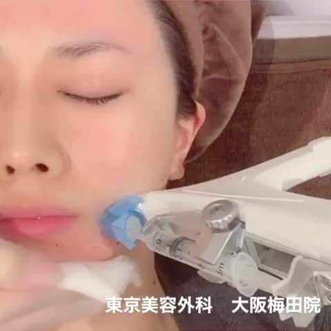 東京美容外科公式のインスタグラム
