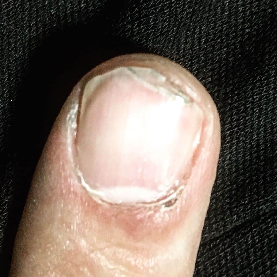 斉藤伸也さんのインスタグラム写真 - (斉藤伸也Instagram)「昨日のハードピッキングで右手人差し指の爪がガタガタになってしまった」12月1日 19時53分 - shytoshinya