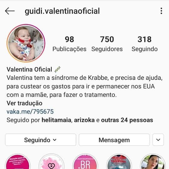 Nicole Bahlsさんのインスタグラム写真 - (Nicole BahlsInstagram)「Gente peço encarecidamente para que quem puder ajudar @guidi.valentinaoficial ela está precisando muito de nós , foi diagnosticada com uma doença rara a Síndrome de Krabbe e os médicos pediram pra mãe correr contra o tempo com os tratamentos .. conheça mais sobre a história dela nesse insta 🙌🏻🙏🙏 se cada um doar 1 real que seja já vai ajudar muito」12月4日 8時43分 - nicolebahls