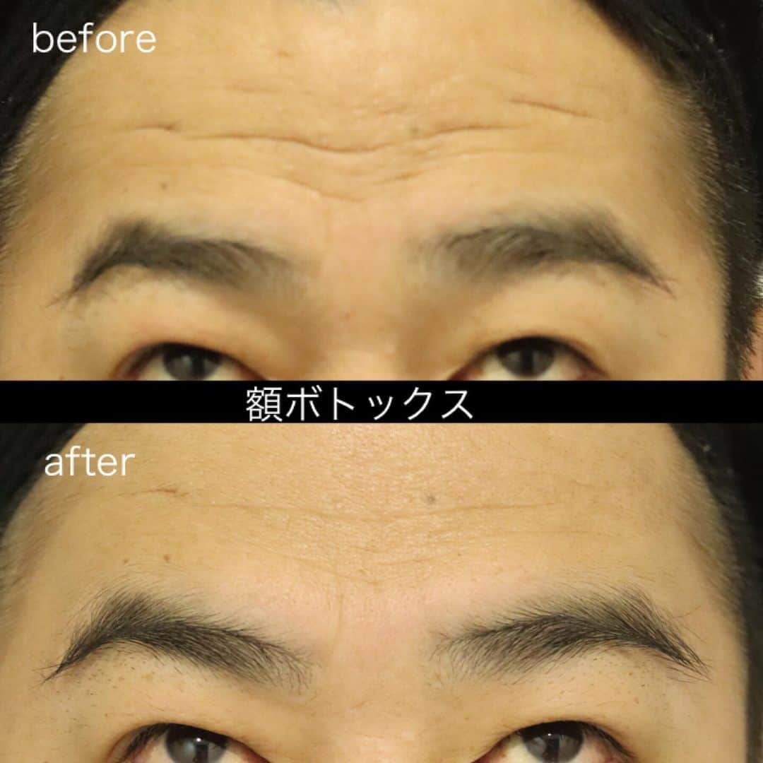 東京イセアクリニックのインスタグラム