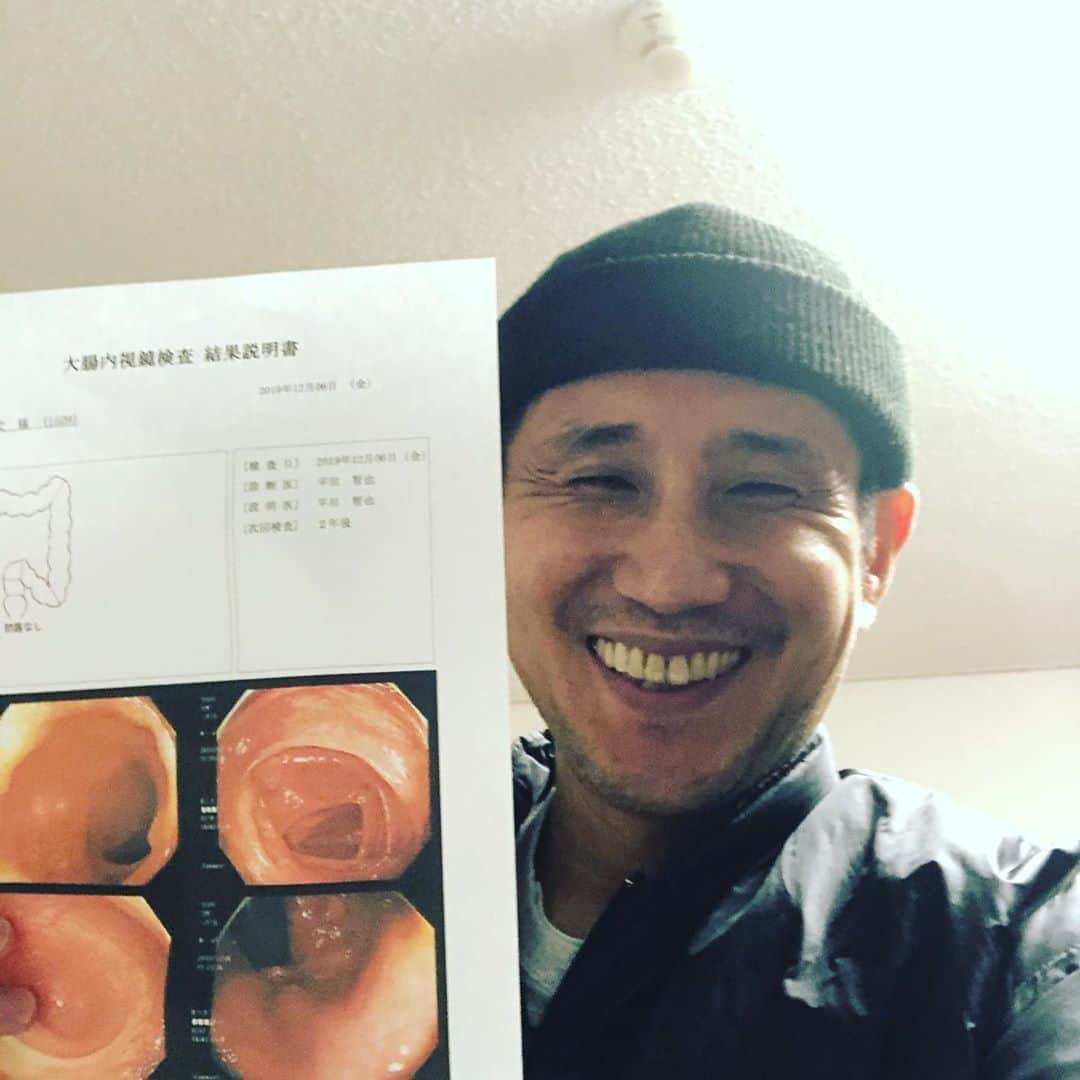 おたこぷーさんのインスタグラム写真 - (おたこぷーInstagram)「ご無沙汰してます。今日、大腸内視鏡検査受けてきました。 なぜかって？ 病院行ったら痔瘻だったからです。 近々、手術です。 その前に大腸の疾患がないかを検査してもらいました。 美しい大腸でした。全く問題なし！ ホッ。 後は、痔瘻の手術！ まさしく次郎丸ですw また手術決まって病室で余裕あればインスタやTwitterで報告しますね。 11月29日に病院いってから、検査やら治療やら働けんやらなんやらかんやらで苦しいですけど、もうなおして頑張るしかない！そがん思っております。 乗り越えるしかない！ ぷー #大腸 #完璧#ぢろう #手術」12月6日 18時32分 - otakopupu