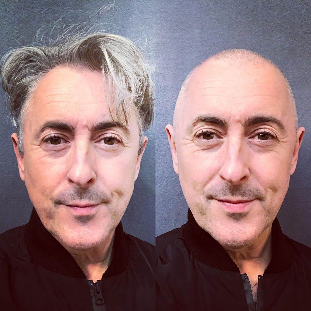 アラン・カミングさんのインスタグラム写真 - (アラン・カミングInstagram)「Morning/ afternoon looks today!#nohairdontcare」1月4日 1時16分 - alancummingreally