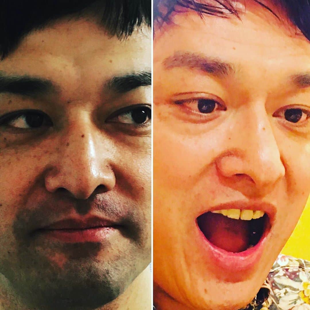 宮田麺児のインスタグラム：「ゴリちゃんのおかげで めちゃくちゃ綺麗になってる 髭さようなら。  #ゴリラクリニック#髭#ヒゲ#脱毛#美肌」