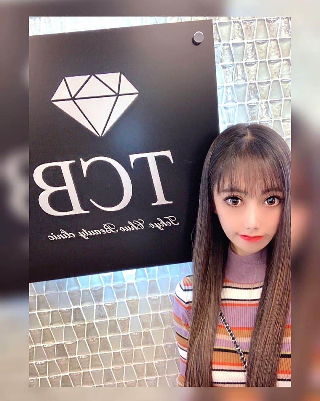 のインスタグラム：「先日『東京中央美容外科 中野院』#@tcb_nakanoで施術していただいたソノクイーンの１ヶ月経過報告✨ ﻿ 顎周りがすんごくスッキリしてシャープな印象になったと言われるようになりました🎶  小顔効果もあるので鏡に映る自分の顔がひとまわり小さくなった気が致します❤️ ﻿ 小顔治療の経験が豊富な磯村先生のおかげです🥰 ﻿ #東京﻿ #中野﻿ #東京中央美容外科中野院﻿ #東京中央美容外科﻿ #TCB﻿ #HIFU﻿ #ハイフ﻿ #ソノクイーン﻿ #リフトアップ﻿ #切らないリフトアップ﻿ #コラーゲン﻿ #たるみ治療﻿ #リフトアップならTCB東京中央美容外科　﻿ #美容整形ならTCB東京中央美容外科　﻿ #美容外科　﻿ #磯村亮輔　﻿ #小顔なら磯村亮輔　﻿ #磯村先生﻿ @tcb_iso﻿ @tcb_nakano」