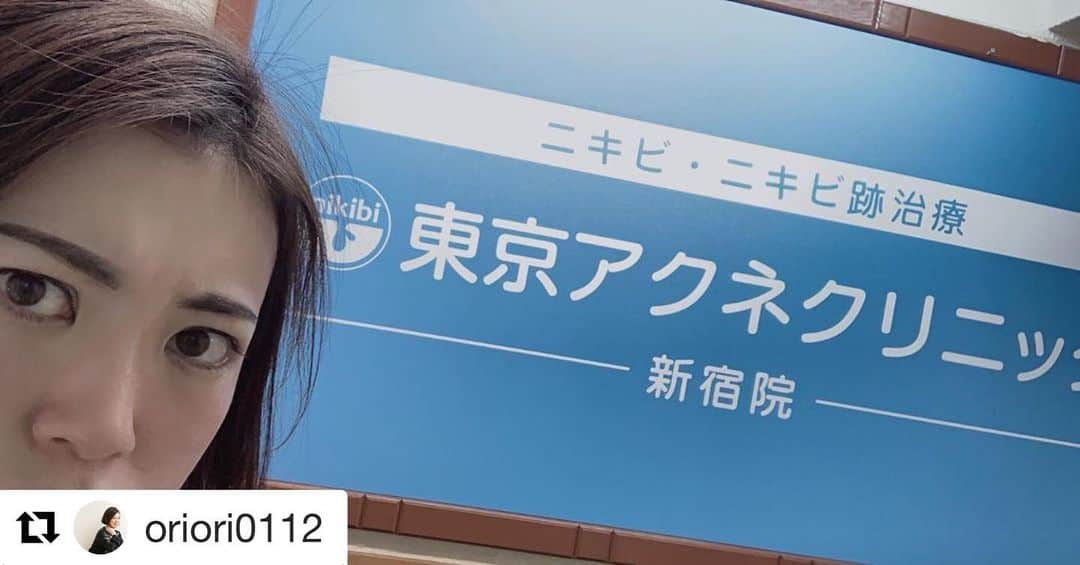 東京アクネクリニックさんのインスタグラム写真 - (東京アクネクリニックInstagram)「oriori0112さん、 ご来院ありがとうございました😊  またのご来院お待ちしております！  #Repost @oriori0112 with @get_repost ・・・ 【ゆる美容POST】 行ってきました！#東京アクネクリニック 新宿院。終わった後で、顔が赤いのと、ドヤ感に溢れたこの表情を見てほしい。  長年悩んでいたニキビ跡の問診。 先生もスタッフも、綺麗な女性ばかりで皆さん笑顔でとても安心して行けました。 先生は、パッと顔を見て何が向いているかをすぐに答えてくれます。 メニューはパンフレットになってまとまっているので見やすい♪ 今回は#プラズマシャワー がいいだろうということで施術🌝 痛みなどは一切なし🤗  #変顔女子 #変顔モデル  #美容アカウントさんと繋がりたい #ニキビ跡 #ニキビ跡ケア #ニキビケア #東京アクネクリニック #東京アクネクリニック新宿院 #プラズマシャワー #ゆる美容 #美容アカウント始めました #美人を目指す #綺麗になりたい #綺麗になりたい人と繋がりたい #コンプレックス」12月16日 20時01分 - nikibi.c