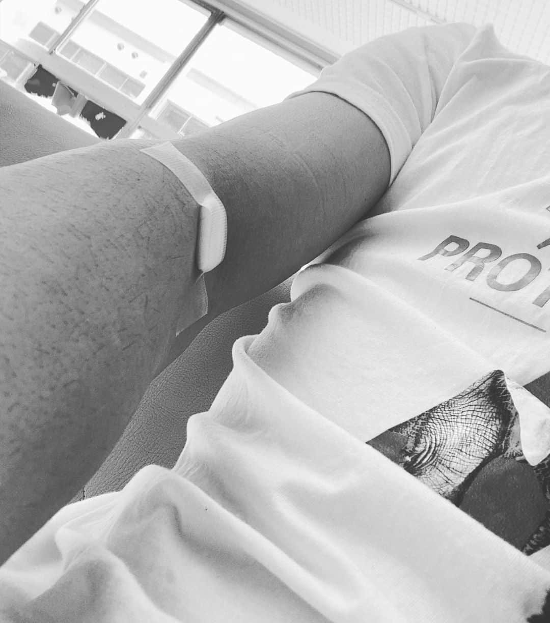 坂井丞のインスタグラム：「今日は三回も針刺したw ゾレア両手に一本ずつと採血！ 良くなりますよーにw #ゾレア #コリン性蕁麻疹 #特発性蕁麻疹 #国立相模原病院アレルギー科」