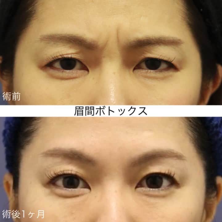 東京イセアクリニックのインスタグラム