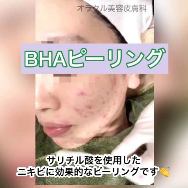 オラクル美容皮膚科東京新宿院のインスタグラム