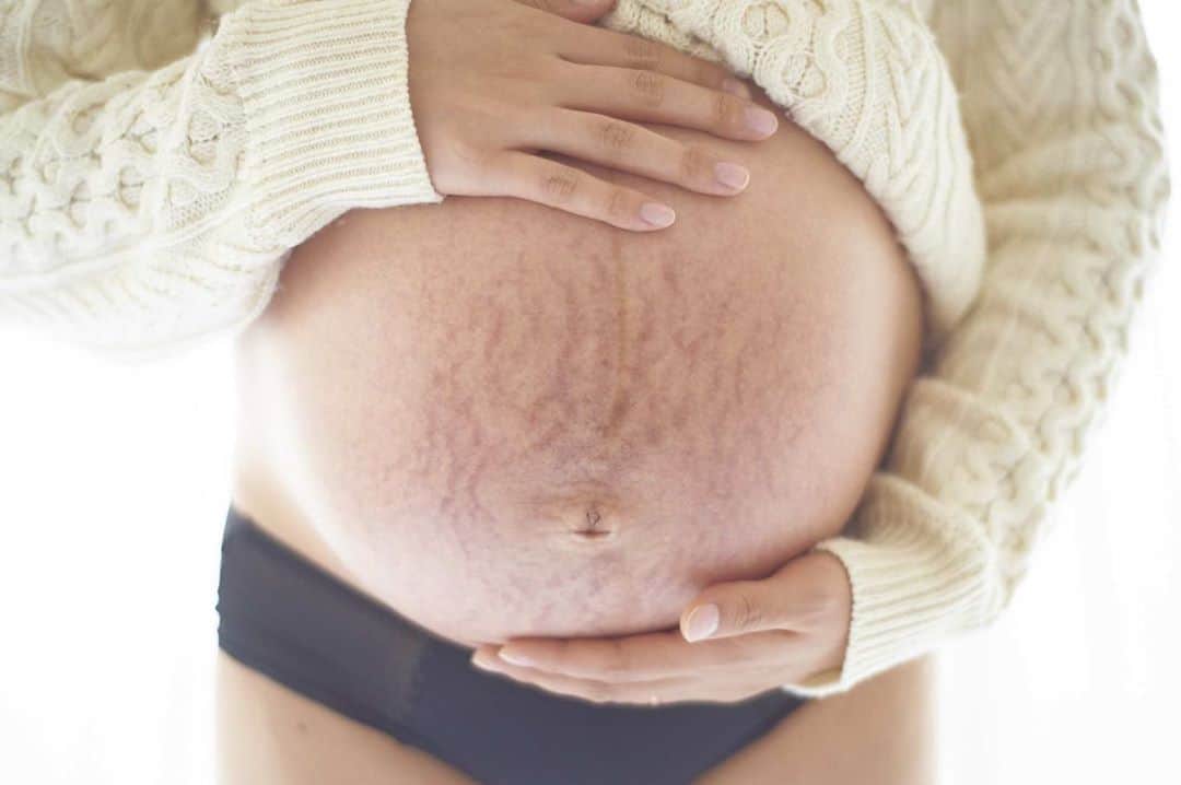 花盛友里のインスタグラム：「先日撮影させてもらった妊婦さま♡ 撮った写真を最後にお渡しする時は、妊娠線や丸みを帯びたところをリタッチすることもできますよーとお伝えしています。 なぜなら自分をどうやって残したいか、を尊重したいから。 でも妊娠して、自分の中にもう一人人間が育っていて、だからお腹に線ができたり脇が黒くなったり赤ちゃん守るために毛が濃くなったり。。 それって素晴らしい事だよねぇ？とっても美しいことだよ、身体が頑張ってる証拠だよー！ってわたしは強く思うの。というより、なにより妊娠中の自分にそう言ってあげたかったから、妊娠中のママさんたちには全力でそう伝えてるの。  ねぇ、今心臓が身体の中に２つもあるなんて凄くない？！ ってね。 そりゃあ色々変わっちゃうよね。  こちらの妊婦さんもすごく気にしてた妊娠線。 でも不思議と写真で見るとあんまり気にならないんだよなぁ、むしろ思い出として残しておくのもいいんじゃないかなぁ？頑張ったお腹の証拠だよ♡って言ってたら、「そうかも、うん、残します♡」って言ってくれました。  そしてこうしてこの写真をシェアしてこの美しさをみた世の中のたくさんの妊婦さんが絶対に勇気付けられると思うんだーって言ったらシェアするのも許可くださいました。  頑張ってるお腹、身体、全部ぜんぶ、愛おしい愛おしい愛おしいよー。 辛いこと多いよね、変わっていく身体、ついて行けないよね。 でも美しいよー！思ってる以上に美しいよ♡  元気に生まれてきておくれよ。 まっているよー！  #hanamorimaternity」
