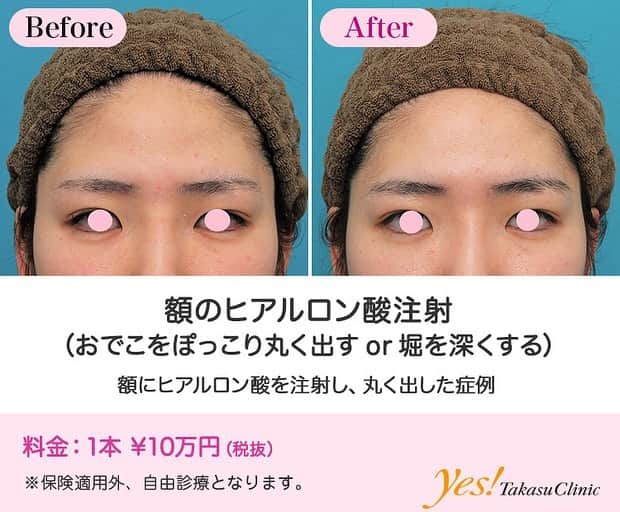 高須クリニックのインスタグラム