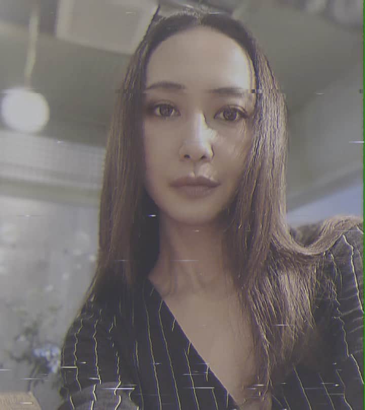 のインスタグラム：「acupressure treatment💆🏻‍♀️ _ 美容の為じゃなくて疲れ目とドライアイ改善の為。笑  仕事上、PC画面を見続けているので 想像以上に目を酷使しているようです。 2020年こそレーシックしたいな👀 (と言いつつ10年くらい経過。) _ #acupuncture #針治療 #ドライアイ改善 #近視」