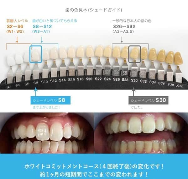 72WHITENING GYMのインスタグラム