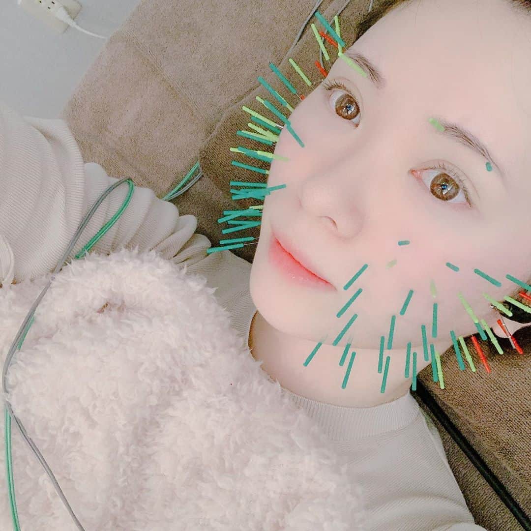 河西美希さんのインスタグラム写真 - (河西美希Instagram)「寝るときの食いしばりが酷すぎる。﻿ ﻿ 頬の高い骨がどんどん膨らんで、﻿ 頭がどんどん四角くなってきて﻿ ここ半年くらいずーっと悩んでて🤦🏻‍♀️﻿ りささんに紹介してもらって﻿ @kadomori_kogao さんに行ってきた！﻿ ﻿ 鍼灸は去年からすごい好きで色んなところ行ったけど @kashiuchi_kadomori さんの施術本当に凄かった…﻿ ﻿ 整顔矯正コースしてもらった後1センチ以上小さくなってたのと、顔を手で触ったとき頬の張りと、頬の幅、頭の大きさが劇的に違って感動しました😢﻿ ﻿ 施術全然痛くなかったし、その後の﻿ ラジオ波シンクロウェーブセットも﻿ 気持ち良くて最高でした！﻿ ﻿ 最近顔大きくなったなあって方は﻿ ぜひ行って見て欲しいレベルのサロンさんでした🥺﻿ ﻿ #KADOMORI #ボコっとした頬が凹んだ #美容鍼 #小顔矯正 #メディカルエステ」1月14日 18時01分 - mikipon1111