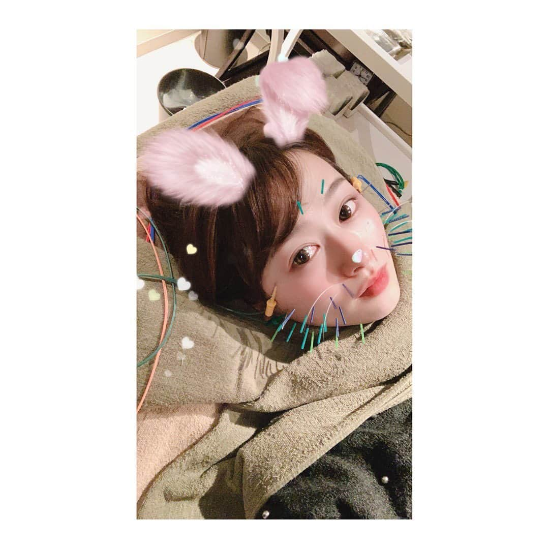 白石茉莉奈さんのインスタグラム写真 - (白石茉莉奈Instagram)「. 鍼初めしました🥰 今年もお世話になります🙇‍♀️ . .  #杉崎先生 @sugizakikenya  #きゅきゅっと美容鍼 #BCARAT式美容鍼 #BCARATbykoritorinic #BCARAT  #笹塚 #笹塚美容鍼 #美容鍼 #美顔鍼 #BCARATはあなたの望みを叶える #ラジオ波#スリミング #ヒートハンド#フィジオスティム #メディカルハンモック #美容 #デトックス#リンパ#アロマ#サロン#エステ #トータルビューティーサロン #beautyacupunture#cosmeticacupuncture」1月15日 1時53分 - marina_shiraishi_official