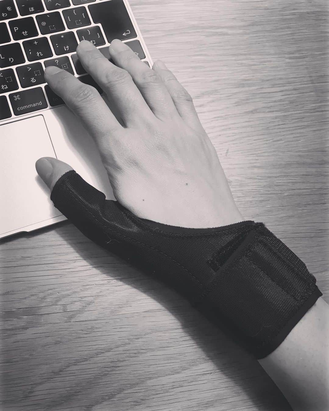 濱中鮎子のインスタグラム：「サポーターしたらだいぶ楽！  今日はたまらず、整形外科へ。 やはりドケルバン腱鞘炎でした。 なんだかかっこいい名前ですが、結構痛いです。瓶の蓋回せません。笑  みなさんにおススメいただいた即効の注射に期待しましたが、まずは塗り薬と湿布をと。  治るかな。 写真のセレクトで親指酷使🤣  #ドケルバン腱鞘炎 #女医さんが面白かった  #汚れるからサポーター黒にしたけど #ウィッシュ感否めない」