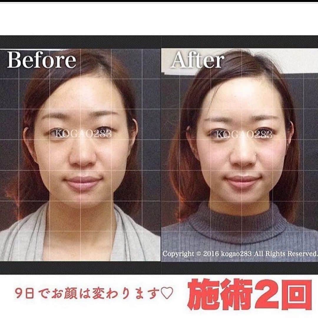 kogao283のグルメインスタ