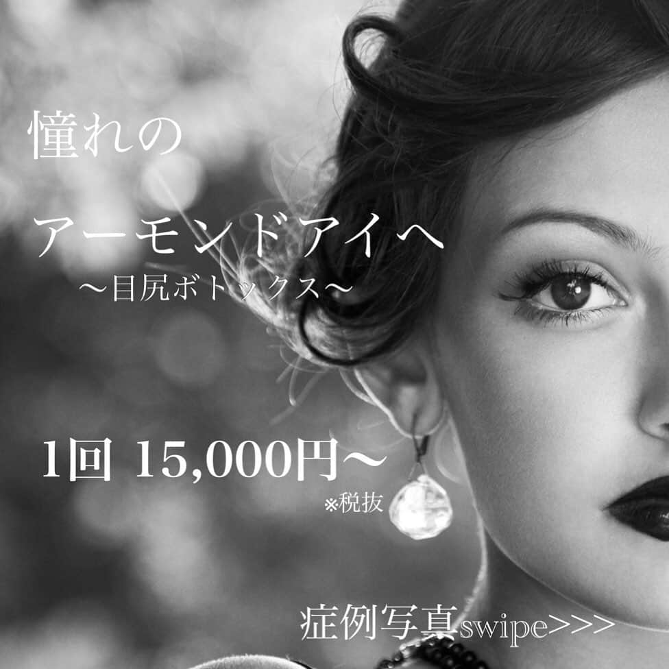 恵比寿フィラークリニックさんのインスタグラム写真 - (恵比寿フィラークリニックInstagram)「注射だけでデカ目👀✨﻿ 『アーモンドアイ』が🙆‍♀️ ﻿ 目を大きくしたい！﻿ つり目が気になる！﻿ タレ目にしたい！﻿ ナチュラルな仕上がりにしたい！﻿ という方におススメです💕﻿ ﻿ ﻿ 注射だけで憧れのアーモンドアイに✨﻿ ﻿ ﻿ *-*-*-*-*-*-*-*-*-*-*-*-*-*﻿ 👀アーモンドアイ(目尻ボトックス)﻿ リジェノックス⇒1回 15,000円﻿ イトノックス⇒1回 18,000円﻿ ボトックス⇒1回 20,000円﻿ ※税抜き表示﻿ *-*-*-*-*-*-*-*-*-*-*-*-*-*﻿ ﻿ ﻿ 2/4横浜院OPENに伴い﻿ 予約スタート致しました🤩💛﻿ ﻿ 続々とご予約のお問い合わせ頂いてます！！﻿ ﻿ ご予約はお早めに💨💖﻿ ﻿ ﻿ ご予約の際は﻿ Instagramを見たとお伝え下さい💛﻿ ﻿ ﻿ #フィラークリニック #目尻ボトックス #タレ目 #タレ目形成 #プチ整形 #fillerclinic #フィラー #注入専門 #注入 #美容 #美容好きな人と繋がりたい #美容オタク #ボトックス #ボトックス注射 #目元 #イメチェン #デカ目 #デカ目効果 #デカ目術 #followｍe」1月23日 16時34分 - filler_clinic