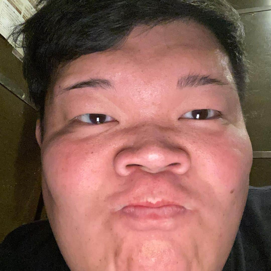 カバのインスタグラム：「‪耳掻きのやり過ぎで、外耳炎と鼓膜近辺がパンパンに腫れあがってていま片耳が聞こえません。皆さまもご注意を。あぁ、痩せたい！‬ . . #本日のでぶ活 #でぶ活 #耳やらかす #あぁ、痩せたい」