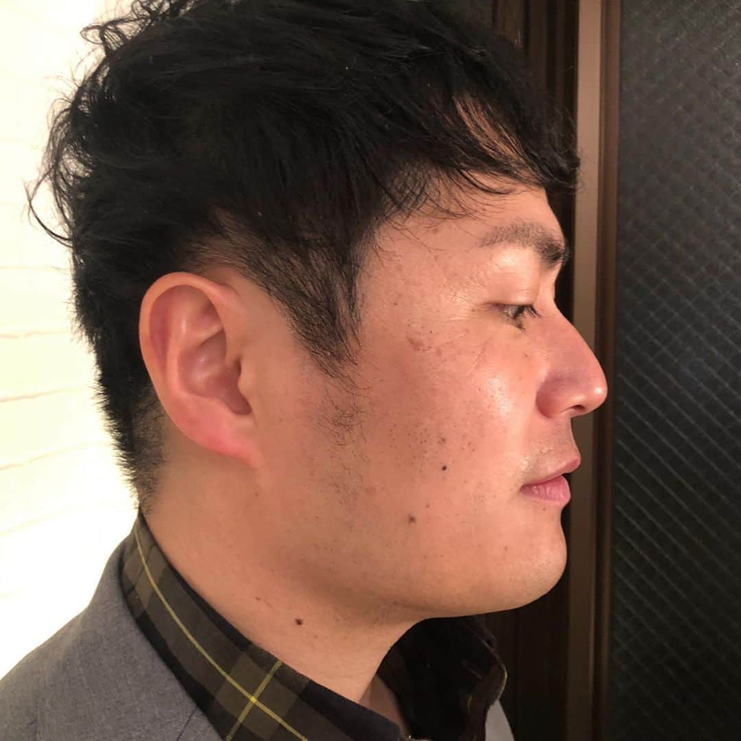 梅村賢太郎さんのインスタグラム写真 - (梅村賢太郎Instagram)「1枚目 3枚目 before  2枚目 4枚目 after  5枚あります☺︎ #エステ #小顔 #むくみ #これはすごい 『梅割り』あります 僕の紹介で @maison_de_mimi0507 フォローしてDMでご予約を☺︎ なんと、、、 【半額に】 僕もこんなに顔小さくなりました！ 通います！！顔なくならへんか心配！  #大阪エステ#フェイシャルエステ #メゾンドゥミミ#大阪#南堀江#南堀江の隠れ家サロン #会員制エステサロン#ご紹介制サロン#南堀江サロン #美肌#エイジングケア #美白#リフトアップ#ニキビケア #アロママッサージ #脱毛#美容好きな人と繋がりたい#osaka#horie#maisondemimi#maison_de_mimi」1月24日 18時21分 - rahujigenume