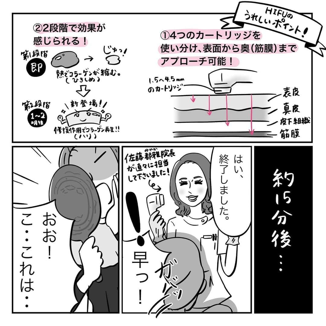 VOCE編集部さんのインスタグラム写真 - (VOCE編集部Instagram)「【漫画】 岡山里香のそれゆけ！ 美人道』 ﻿ vol.35 〜話題のハイフで整形級のリフトアップ〜﻿ ・﻿ ﻿ インスタで話題のマンガ家・岡山里香さん﻿ ﻿ @rikaokayama_pro による﻿ ﻿ ビューティ追求漫画『岡山里香のそれゆけ！ 美人道』。 ﻿ ・﻿ ﻿ 表参道にできたばかりの新しいビューティクリニックで人気の「ハイフ」を体験してきた岡山先生🏃‍♀️✨﻿ @m_skin_dr @belumi_clinic ・﻿ ﻿ リフトアップ効果がすごい！と噂ですが、岡山先生が「整形級」と驚くbefore & afterとは⁈👀✨﻿ ﻿ 『岡山里香のそれゆけ！ 美人道』は隔週金曜UP。﻿ ﻿ 次回の更新は3月6日（金）です。お楽しみに❤️ ﻿ ﻿ #それゆけ美人道 vocemagazine #岡山里香 #ヴォーチェ #美容 #beauty #漫画　#belumi表参道クリニック　#ベルミクリニック」2月21日 20時51分 - vocemagazine