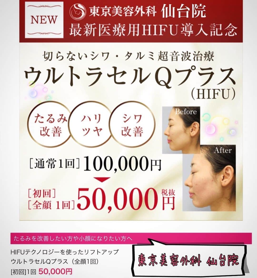 東京美容外科公式さんのインスタグラム写真 - (東京美容外科公式Instagram)「💗東京美容外科仙台院です💗 仙台院にも、大人気のHIFU「ウルトラセルQプラス」がついに導入しました❣️✨ ・ ウルトラセルQプラスは、HIFUという超音波で肌の奥にエネルギーを届けて肌を引き締める効果を得る「切らないたるみ治療」なんです😯💖 たるみは気になるけど、手術はちょっと…という方やダウンタイムが気になる方💦 気軽にお肌を引き締めたい方へおすすめです😊💕 現在、導入記念のキャンペーン実施中です❣️ 気になる方はswipe👆 是非ご来院、お待ちしております💁🏻‍♀️✨ ・ 🌷水光注射12ヶ月プラン(リジュラン除く) ¥300,000 . 🌷ヴェルベットスキン ¥45,000（初回） . その他メニュー各種ございます😊💕 お気軽にお問い合わせくださいませ🍏🍎 各線「仙台駅」より徒歩5分、JR仙石線「あおば通駅」より徒歩2分 ♡ 東京美容外科 仙台院にぜひお越しください！😇 . ====🎁お問い合わせはこちら🎁==== 詳しくはプロフィールのURLから公式サイトへ♪ ▼フリーダイヤル 0120-658-958 （コールセンター受付時間：9：00～21：00） ▼LINE予約 @ tkc110 ========================= . #東京美容外科 #東京美容外科仙台院 #仙台 #宮城 #美容 #美容整形 #cosmeticsurgery #整形 #美活 #きれいになりたい #美肌 #美意識  #美容外科 #プチ整形 #韓国  #エイジングケア #アンチエイジング #美容好き #韓国美容 #美容整形外科 #小顔 #ほうれい線 #たるみ改善 #切らないたるみ治療 #hifu #ウルトラセルqプラス」2月23日 13時48分 - tokyobiyougeka_jimukyoku