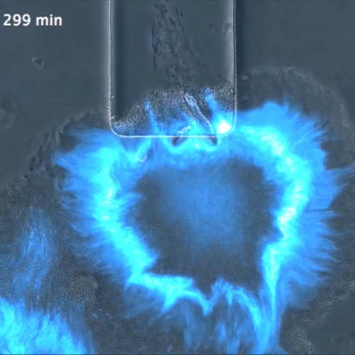 TED Talksのインスタグラム：「Bacteria had a glow up! This growing colony of fluorescent bacteria — dubbed “The Supernova” by synthetic biologist and TED Fellow Tal Danino — lights up only after it reaches a high density. Not only does it look cool, but this innovative use of microbes has enormous implications for potentially detecting and treating cancer and other diseases. “Like writing software, we can print and write DNA into different algorithms and programs inside of bacteria,” says Danino. Click the link in our bio to learn more about this new approach.」