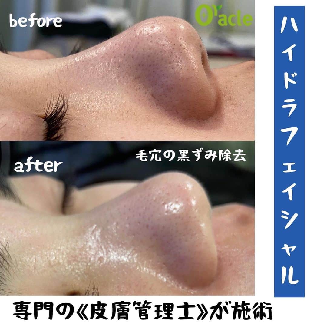 オラクル美容皮膚科東京新宿院のインスタグラム
