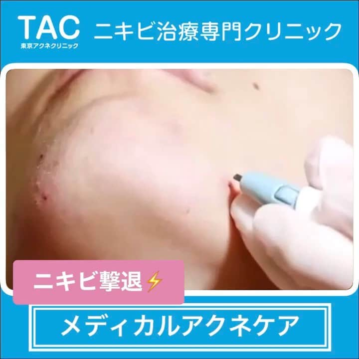 東京アクネクリニックのインスタグラム