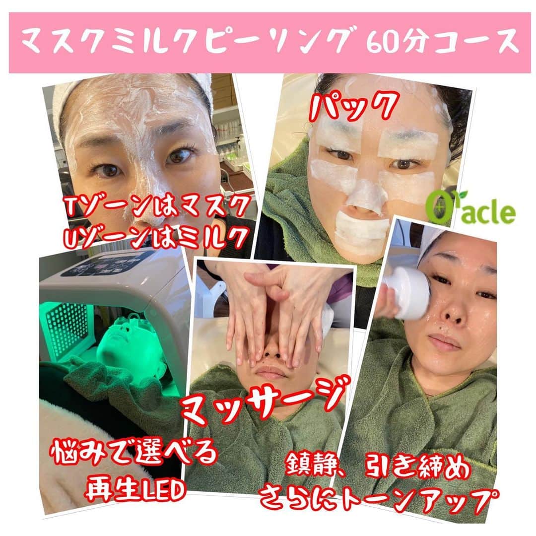 オラクル美容皮膚科東京新宿院さんのインスタグラム写真 - (オラクル美容皮膚科東京新宿院Instagram)「🍼マスクミルクピーリング🍼﻿ ロング（60分）コースを体感‼️﻿ 施術たっぷりで満足度⭐️⭐️⭐️﻿ ﻿ 🙎🏻‍♀️40代女性　目的:アンチエイジング﻿ ﻿ ▪️▫️▪️▫️▪️▫️▪️▫️▪️▫️﻿ ﻿ 【レポ】﻿ 最初に専用のフォーマー（泡）で汚れをしっかり取ります﻿ ➡︎この時点でちょっとピリピリ﻿ ﻿ そのあと、Tゾーンにマスクピールを塗布﻿ ➡︎ピリピリ感増します﻿ ﻿ Uゾーンにミルクピーリング塗布﻿ ➡︎全体的にかなりピリピリします。熱感あり。﻿ ﻿ その後、すぐに洗顔（お湯）するので、ピリピリは少しの我慢です。﻿ ﻿ ここからがすごい‼️﻿ ﻿ 洗顔後は専用の機器で、冷却しながら鎮静と保湿、引き締め、トーンアップ﻿ ➡︎かなり冷たいですが、ピーリングで熱感があったので気持ちいい。﻿ 開いた毛穴が引き締まりそうです。﻿ しっかり鎮静した後は…﻿ ﻿ マッサージ﻿ ➡︎これがとっても気持ちよい。﻿ リラクゼーション効果抜群。﻿ 寝てしまいそうでした﻿ ﻿ さらにオラクルパック﻿ ➡︎目の周りまでしっかり保湿します。﻿ ﻿ さらにさらに﻿ ➡︎再生LEDレーザーでケア﻿ ハリ、美白効果の緑のライトをチョイス﻿ ﻿ LEDレーザーはお悩みや目的で﻿ ブルー、赤など選択できます。﻿ ﻿ 終了﻿ ﻿ これだけたっぷりの工程でかなり満足度高いです。﻿ さらに翌日のお肌すべすべで驚きです。﻿ 毛穴引き締まった感じが分かります。﻿ ﻿ そしてトーンアップ効果⤴️﻿ 最近気になっていた赤みが改善。﻿ ﻿ ▪️▫️▪️▫️▪️▫️▪️▫️▪️▫️﻿ ﻿ マスクミルクピーリングはロングコースがかなりお得です。﻿ ﻿ 【効果】﻿ 美白、保湿、ハリ・ツヤ、くすみ、しみ 、色素沈着、毛穴、角質、アンチエイジング﻿ ﻿ ▪️▫️▪️▫️▪️▫️▪️▫️▪️▫️﻿ ﻿ 【料金】﻿ ﻿ 🍼30分コース 12,000円（税抜）﻿ 保湿効果の高いゴムマスク付き﻿ ﻿ 🍼60分コース 21,000円（税抜）﻿ 冷却式イオン導入+浸透マッサージ+再生LEDレーザー+シートマスク付き﻿ ➡︎かなりお得です🉐🉐🉐﻿ ﻿ ▪️▫️▪️▫️▪️▫️▪️▫️▪️▫️﻿ ﻿ ⚠️リスクなど﻿ ダウンタイムはほぼなし﻿ 2-3日後軽い皮向けがある場合あり﻿ 施術中ピリピリ感がある場合あり﻿ ﻿ ▪️▫️▪️▫️▪️▫️▪️▫️▪️▫️﻿ ﻿ 【特徴】﻿ ﻿ 🧪皮脂の通り道Tゾーン﻿ マスクピール﻿ ベントナイトにより皮脂や角質の汚れを吸着し、毛穴のつまりを予防改善。﻿ ﻿ 🍼乾燥するUゾーン﻿ ミルクピーリング﻿ グリコール酸・サリチル酸・乳酸(ラクト) の成分で刺激が少なくお肌に優しい薬剤でお肌のトラブル改善﻿ ﻿ ▪️▫️▪️▫️▪️▫️▪️▫️▪️▫️﻿ ﻿ 🇯🇵オラクル美容皮膚科🇰🇷﻿ 📍新宿3丁目19-4 MLJ新宿8階﻿ ﻿ 【専門】﻿ ニキビ（跡）／毛穴／シミ／しわ／たるみ／痩身／アンチエイジング／美白美肌治療全般／ブライダル相談﻿ ﻿ 🗝完全予約制﻿ 👠土日祝日も診療﻿ ﻿ 【予約方法】﻿ ☎0120-905-696﻿ ⏰9:00～21:00［年中無休］﻿ ﻿ LINE、メール24時間📧﻿ LINE🆔 @oracle.jp ﻿ 📩HPメールフォームよりお願いいたします﻿ ﻿ ▪️▫️▪️▫️▪️▫️▪️▫️▪️▫️﻿ ﻿ #美容 #美容皮膚科 #アンチエイジング　#ハリ肌　#美白﻿ #艶肌　#韓国美容皮膚科﻿ #ミルクピーリング #ピーリング﻿ #グリコール酸 #マスクピール #マスクピーリング #サリチル酸 #ニキビ治療 #美肌 #ミルクピール #美容マニア #美容マニア御用達 #美容好きな人と繋がりたい #美容好き #美容好きさんと繋がりたい #韓国美容 #韓国好きな人と繋がりたい #韓国好きな人と仲良くなりたい #韓国好き男子」2月7日 9時14分 - oraclejp