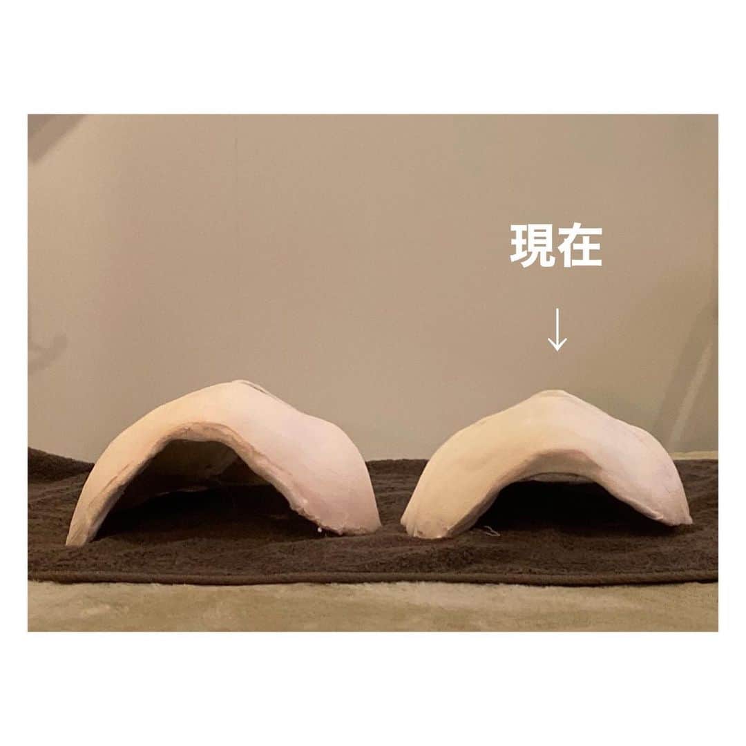 荒牧陽子さんのインスタグラム写真 - (荒牧陽子Instagram)「2020.2.某日　コルギ﻿ ┈︎┈︎┈︎┈︎┈︎┈︎┈︎┈︎┈︎┈︎┈︎┈︎﻿ 数年通っているコルギ。﻿ 久々に石膏しました。﻿ 写真3枚目、4枚目が、変化分かりやすいよ。﻿ ﻿ 顔の歪みはもちろん、﻿ 首、肩、背中を流してもらって﻿ 顔の老廃物を流してもらえるのが﻿ 【エステとコルギ】て感じで好き﻿ 浮腫とコリでムクムクになっちゃう私にはすごく合ってる。﻿ ﻿ 最初はめっちゃ痛いよ！﻿ でも3回目くらいからは気持ちいい。﻿ ┈︎┈︎┈︎┈︎┈︎┈︎┈︎┈︎┈︎┈︎┈︎┈﻿ #荒牧陽子﻿ #コルギ﻿ 最近通えてなくて久々に行ったら激痛で涙。﻿ ちゃんとコンスタントに通えばもっと変化出たと思う。﻿ そして最近、頭の凝りが激しいことを知り、ヘッドマッサージャー買ってみた﻿」2月10日 10時19分 - yoko_aramaki