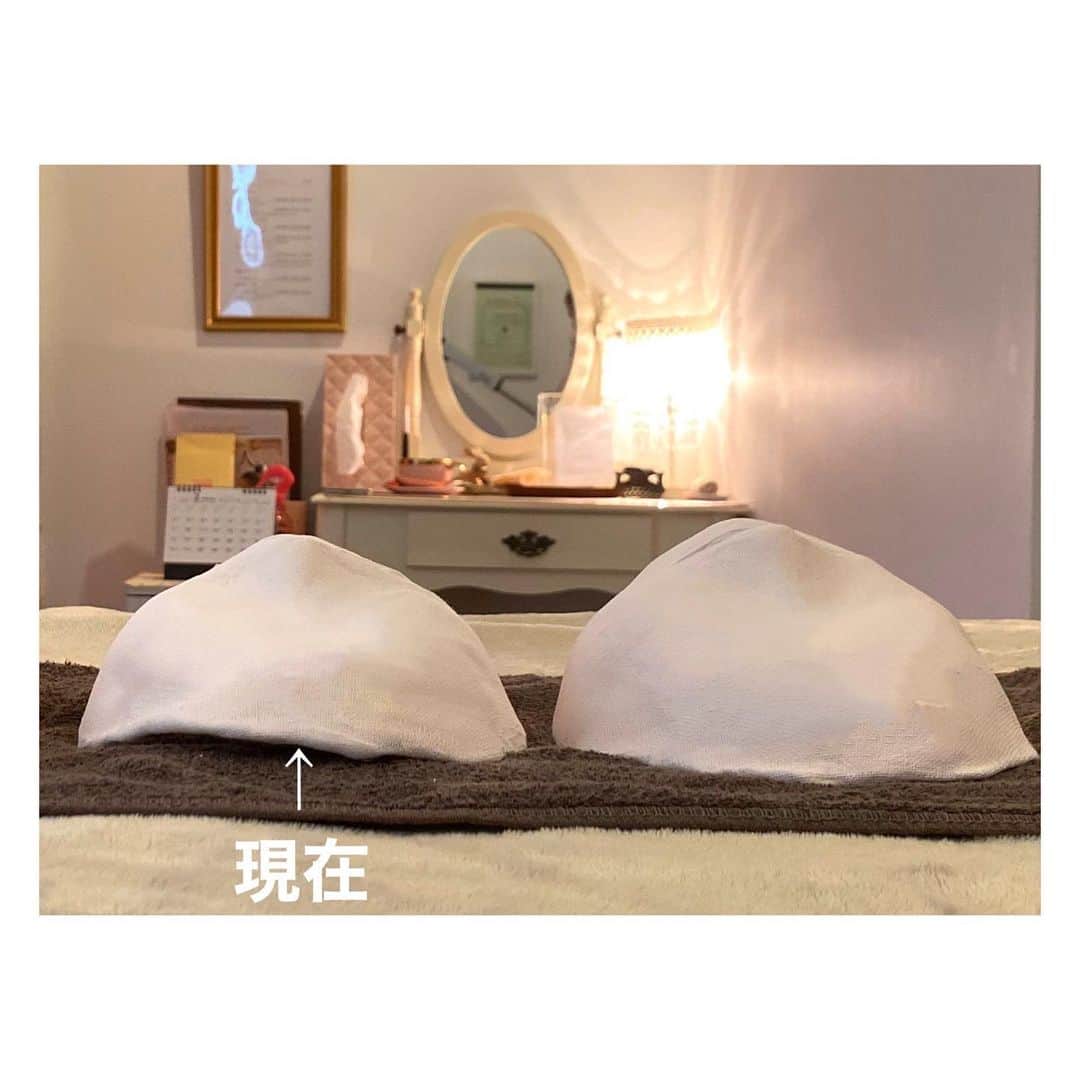荒牧陽子さんのインスタグラム写真 - (荒牧陽子Instagram)「2020.2.某日　コルギ﻿ ┈︎┈︎┈︎┈︎┈︎┈︎┈︎┈︎┈︎┈︎┈︎┈︎﻿ 数年通っているコルギ。﻿ 久々に石膏しました。﻿ 写真3枚目、4枚目が、変化分かりやすいよ。﻿ ﻿ 顔の歪みはもちろん、﻿ 首、肩、背中を流してもらって﻿ 顔の老廃物を流してもらえるのが﻿ 【エステとコルギ】て感じで好き﻿ 浮腫とコリでムクムクになっちゃう私にはすごく合ってる。﻿ ﻿ 最初はめっちゃ痛いよ！﻿ でも3回目くらいからは気持ちいい。﻿ ┈︎┈︎┈︎┈︎┈︎┈︎┈︎┈︎┈︎┈︎┈︎┈﻿ #荒牧陽子﻿ #コルギ﻿ 最近通えてなくて久々に行ったら激痛で涙。﻿ ちゃんとコンスタントに通えばもっと変化出たと思う。﻿ そして最近、頭の凝りが激しいことを知り、ヘッドマッサージャー買ってみた﻿」2月10日 10時19分 - yoko_aramaki