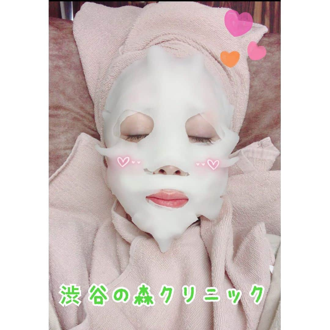 大原かおりさんのインスタグラム写真 - (大原かおりInstagram)「♡♡♡ 最近、美容に力を入れ出した私🙋‍♀️💕 緑色の顔の次は…白顔〜😆www ⑅◡̈⑅ 先日、いつ会ってもキレイな平山美香ちゃん @mika_hirayama に オススメしてもらった『渋谷の森クリニック』で、初の水光注射を施術してきました💖 ⑅◡̈⑅ 水光注射は、皮膚の浅い層にわずかに針を刺して美容成分を細かく打って効果的に美容成分を届けてくれるそうです🥰✨ 韓国の人気の若返り美容方法💡 ⑅◡̈⑅ 渋谷の森クリニックでは、水光注射前に30分くらい麻酔クリームを塗ってから施術してもらうので、痛みも腫れもほとんどなくハリを出してくれます💖💖💖 写真は、施術終わりにパックしているところよっ♡♡♡ ⑅◡̈⑅ 施術終わりも少しだけ内出血する部分があったけどほとんど目立たず、すぐにメイクもできるので嬉しいなっ❣️ 肌のうるおい感とツヤ感がアップしてくれて…わたくし喜びに満ち溢れております👏😝💘 ⑅◡̈⑅ それと渋谷の森クリニックで人気のビタミンローションも毎日欠かさず使ってます😘💋 美容にかけている時間が最近とても楽しいので、引き続き美しくなる方法を勉強していきたいと思います🙋‍♀️💖 ⑅◡̈⑅ 🌳 渋谷の森クリニック🌳💕 渋谷区神宮前6-18-1-4階 0120-612-777 AM10:00〜PM19:00 https://shibuyamori.com ・ #渋谷 #神宮前 #渋谷の森クリニック #おすすめのクリニック #VCLotion #美容外科 #医療脱毛 #水光注射 #あまり痛くなかったよ #肌表面 #抗酸化成分 #美肌効果 #肌質改善 #コラーゲン #潤い #ハリ #ツヤ #弾力 #透明感 #肌改善 #韓国美容 #美容 #美肌になりたい #頑張る #美容好きな人と繋がりたい #😘💕」2月25日 20時39分 - oharagaori_otty