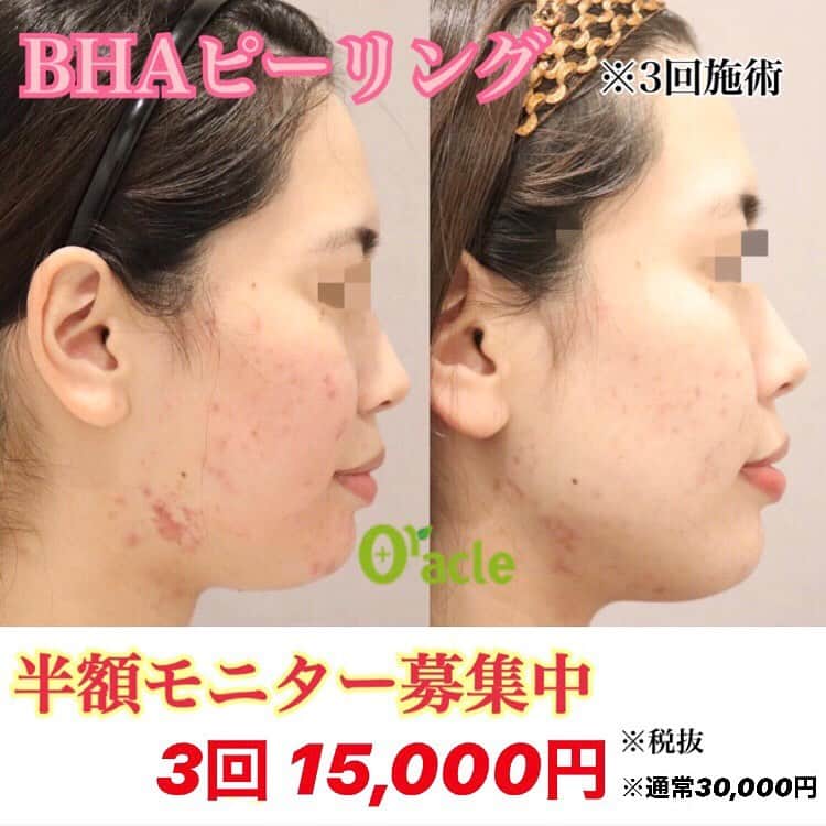 オラクル美容皮膚科東京新宿院のインスタグラム