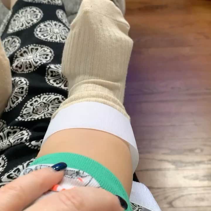 ディーナ・ニコール・コルテーゼのインスタグラム：「A little update on CJs feet .. since some of my followers have been asking how it’s going .. so for some that don’t  know CJ has metatarsus adductus (his feet curve inward) and these braces will help correct it 👍🏼 the last video is the first day he got them .. him trying to walk but I got him non-slip socks since then 👌🏼」