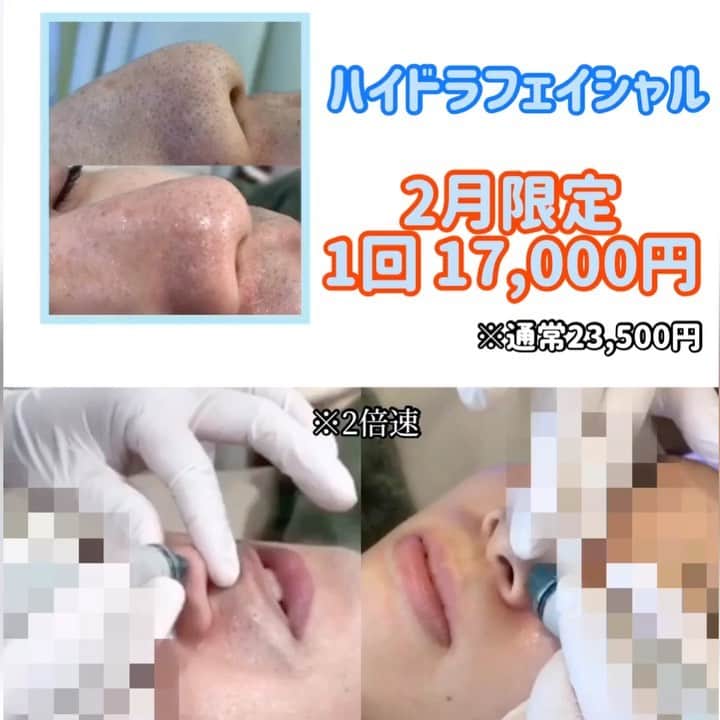 オラクル美容皮膚科東京新宿院のインスタグラム