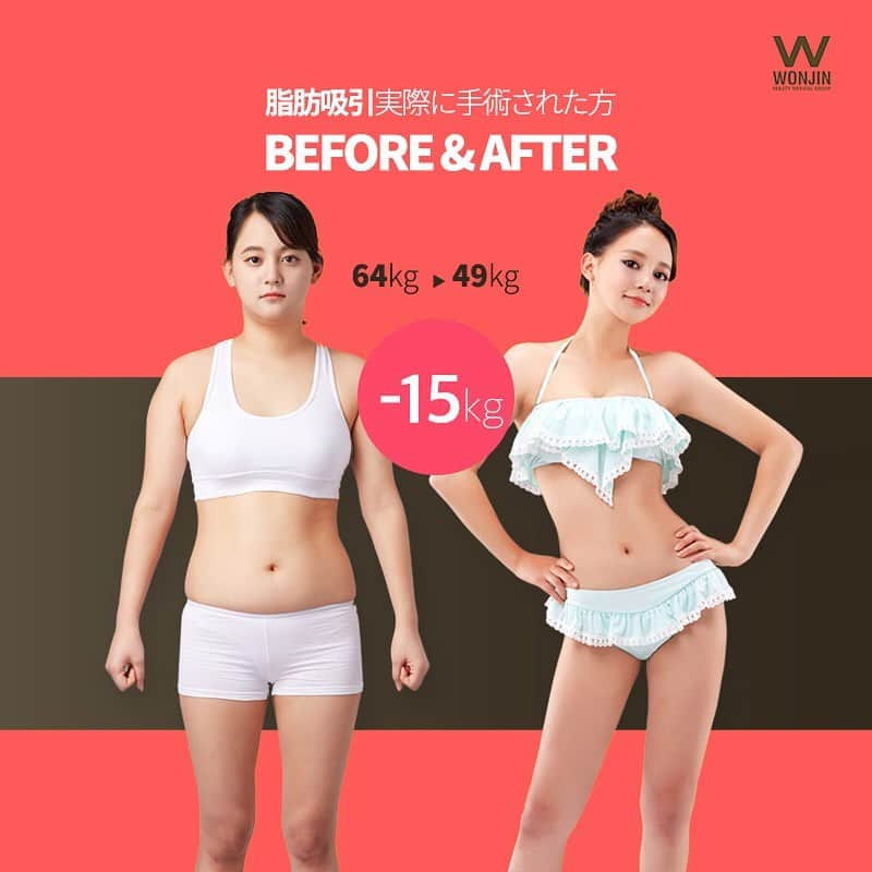 ウォンジン美容整形外科、皮膚科さんのインスタグラム写真 - (ウォンジン美容整形外科、皮膚科Instagram)「⠀ ウォンジン整形外科 ⠀ 気になる脂肪を一気に解決👌 ウォンジンオールインワン脂肪吸引 ⠀ 根こそぎ吸引し 憧れのスリムボディに変身‼️ ⠀ 日本相談会受付中🇯🇵 🗼東京▶️ 2/22-23※ 締め切り直前 🏯大阪▶️ 4/11　絶賛受付中！ ⠀ 相談会のお申し込みは必ずウォンジン公式ライン(@wonjin)までご連絡下さいませ📲 ⠀ (美容整形、芸能人の皮膚管理ノウハウ、アイドルのダイエット秘訣など 日本カウンセリング会予約・各種イベントについてもこちらへ💁♀✨) LINE: @wonjin SITE:jp.parkwonjin.co.kr E-mail: wonjin.jpn@gmail.com ⠀ #韓国美容整形 #韓国美容外科 #韓国整形 #整形 #美容外科 #ウォンジン #ウォンジン整形外科 #美容整形 #脂肪吸引 #ダイエット #脚痩せ #痩身 #痩せる方法 #スリム #くびれ #無料カウンセリング #カウンセリング会 #相談会 #無料相談会 #整形割引 #割引情報」2月20日 10時14分 - jp.wonjin