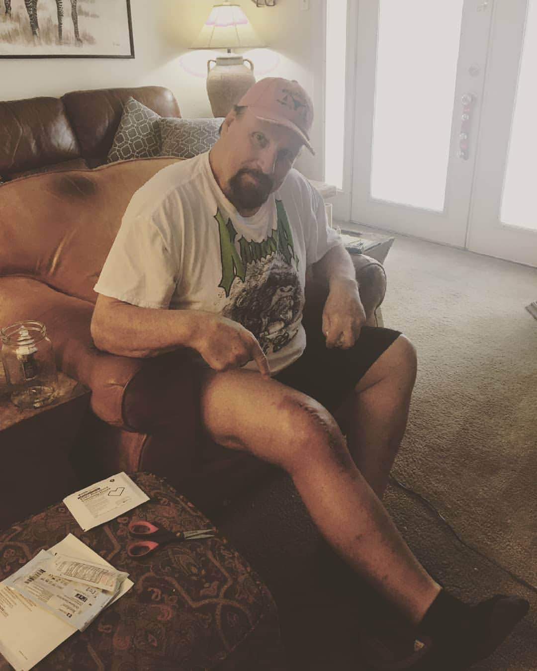 スコット・ノートンさんのインスタグラム写真 - (スコット・ノートンInstagram)「Update on the knee, still a little swollen but healing up great #2weeksout #totalkneereplacement #scottnorton #scottflashnorton #strongstyle」3月20日 8時43分 - scottflashnorton