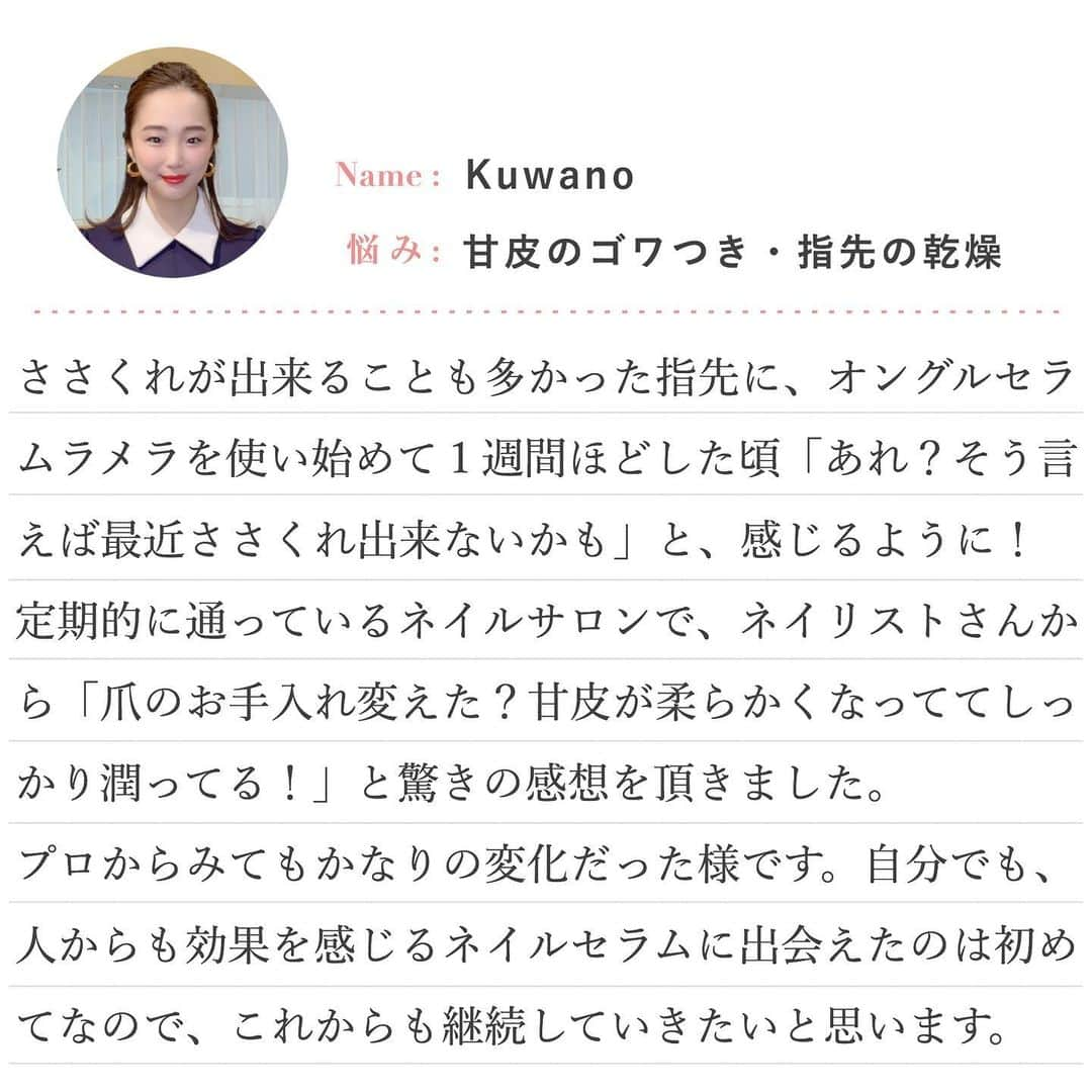 blanche étoileさんのインスタグラム写真 - (blanche étoileInstagram)「発売から大好評の#爪用美容液 《 オングル セラム ラメラ 》👏🏻🌹 . . 📍こんな爪のお悩みがある方にお勧めです ☑︎ 爪表面の凹凸が気になる ☑︎ 爪がもろく割れやすい ☑︎ 爪の厚み・薄さが気になる ☑︎ 指先の乾燥が気になる ☑︎ 甘皮が固くごわつく ☑︎ 二枚爪になりやすい . . また、実際に使用しているスタッフの リアルな使用感を お悩みに合わせてご紹介致します✨ . . 商品の詳細については、 店頭のスタッフ💁🏻‍♀️または、オンライン📱にて ご確認くださいませ💅🏻💓 . . 📌#オングルセラムラメラ 10g ¥3,200(+tax) . . #濱田マサル #blancheétoile #ブランエトワール #ONGLESSÉRUMLAMELLAIRE #ネイルケア」2月26日 13時25分 - blanche_etoile