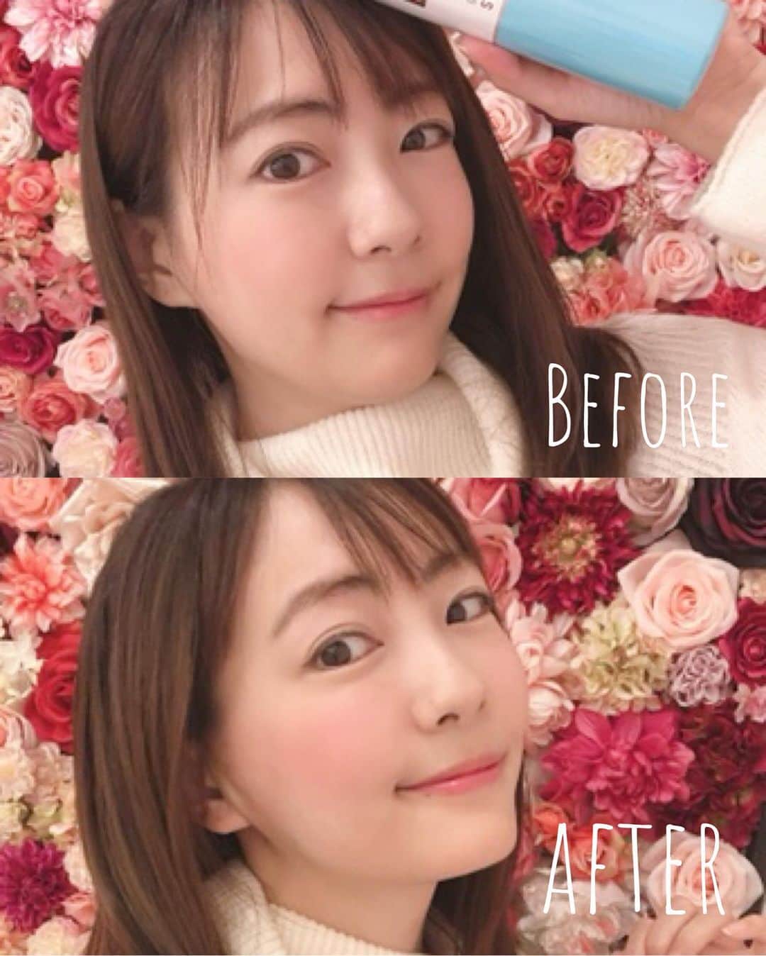 うえむらちかさんのインスタグラム写真 - (うえむらちかInstagram)「事務所の友達に @aclinic_ginza の #谷口弘樹 先生（@dr.taniguchi）を紹介してもらって、 #リフトアップ してきました♬﻿ ﻿ #Aスレッド は一年ぶり💓﻿ ﻿ 今回もさらにシュッとして﻿ やっぱり気付いたらドヤ顔してる〜笑﻿ ﻿ ドヤ顔フェイスライン と呼んでます😂✨﻿ ﻿ ﻿ 院内もとても綺麗で﻿ #映えスポット 過ぎてたくさん写真撮って遊んじゃいました📸﻿ ﻿ ﻿ 谷口先生のインスタグラムの他の症例写真も綺麗だから覗いてみてね💕﻿ ﻿ #美容好きな人と繋がりたい﻿ #aスレッド #aclinic #aclinic銀座﻿ #aクリニック #美容 #小顔 #美肌 #リフトアップ #美容外科 #美容皮膚科 #美容クリニック」2月28日 0時24分 - uemurachika