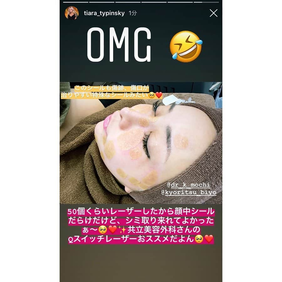 共立美容外科・歯科・皮膚科さんのインスタグラム写真 - (共立美容外科・歯科・皮膚科Instagram)「ありがとうございました🎉 またお待ちしてます😘 @tiara_typinsky ・ #共立美容外科 #共立美容外科渋谷院 #芸能人御用達 #dj #TIARA #パリピ #パリピ女子 #qスイッチレーザー #qスイッチyagレーザー #qスイッチヤグレーザー #しみ取り #シミ取り #しみ取りレーザー #シミ取りレーザー #シミ対策 #シミケア #しみ治療 #シミ治療 #美肌 #美肌ケア #レーザー治療」2月28日 11時44分 - kyoritsu_biyo