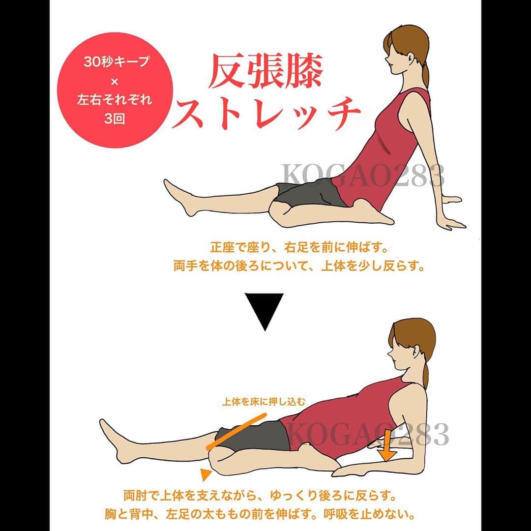 kogao283さんのインスタグラム写真 - (kogao283Instagram)「反張膝  #太ももストレッチ❷ 大腿四頭筋は太ももの前面にある筋肉で、ひざを伸ばす膝関節の伸展動作と太ももを前に挙げる（股関節の屈曲）動作、骨盤を立てる（骨盤の前傾）動作の際に働いています。  この筋肉が硬くなると、ひざを深く曲げられなくなったり、太ももを体幹の後ろに伸ばす（股関節の伸展）動作の関節可動域が小さくなってしまいます。 筋力が弱くなると、太ももを前に高く挙げられなくなったり、ひざを真っ直ぐに伸ばす動作が困難となります。  もも前の筋肉の張り、凝りを緩和したい人、膝を曲げる動作を柔らかくしたいにオススメのストレッチです。」2月29日 18時25分 - kogao283