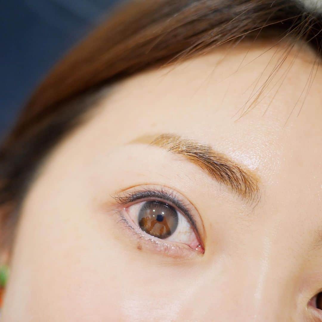 木本泉さんのインスタグラム写真 - (木本泉Instagram)「-﻿ @tokyo_hills_clinic へ @mesm_medical_skin_make の施術へ👀﻿ ﻿ インラインの2回目﻿ ﻿ 1回目にかなり定着していたけれど、やっぱり入れるとまたくっきり💡﻿ 3回くらいすると、しっかり色が入るみたいです！﻿ ﻿ 花粉症なので、この時期 毎年アイラインがよれて大変だったので、本当にやって良かった🌿﻿ スッピンの時も目がくっきりするので、ぼやけた感じがなくなります！﻿ ﻿ #mesm#メスム#インライン#アイライン#美容#beauty」3月1日 14時08分 - izumikimoto