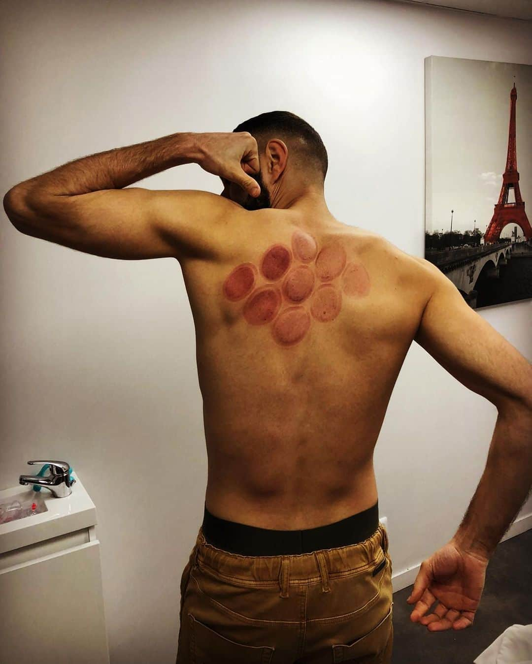 カリム・ベンゼマさんのインスタグラム写真 - (カリム・ベンゼマInstagram)「Recovery Nueve ⚔️🔥」3月3日 21時46分 - karimbenzema