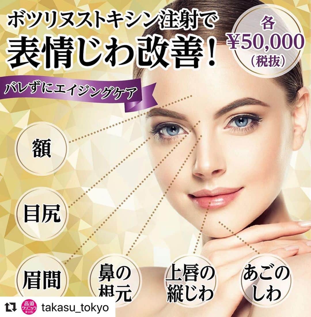高須クリニックさんのインスタグラム写真 - (高須クリニックInstagram)「. ━･･━･･━･･━･･━･･━･･━ #Repost @takasu_tokyo ━･･━･･━･･━･･━･･━･･━ 注射1本、5分程で施術が完了する注射式しわ取り。﻿ その中でも、額の横じわ、眉間の縦じわ、目尻の笑いじわなど、表情のくせによる頑固なシワに効果的なのが、『ボツリヌストキシン注射』です。﻿ 表情筋の過剰な動きを和らげることで、しわの原因そのものを断つのが、ボツリヌストキシンの特徴。﻿ すでにあるしわを目立たなくするのはもちろん、将来のしわまで予防することが可能です。﻿ ﻿ 【🌿料金】﻿ ●注射式シワ取り ボツリヌストキシン注射﻿ 額・眉間・目尻・口周り・鼻の根元ジワ・あごの梅干しジワ 各￥50,000（税抜）﻿ ［全院］﻿ ﻿ 【⚠️副作用・リスク】﻿ ●注射式シワ取り ボツリヌストキシン注射﻿ 内出血（注射針が血管に当たってしまった場合）、妊活・妊娠・授乳中の方への施術不可、眉が下がる、目が細くなる可能性、目が開けにくくなる、眼瞼下垂になる可能性﻿ ﻿ 【ご予約・お問合せ】﻿ ➿0120-5587-15﻿ ﻿ #高須クリニック　#高須克弥　#美容　#美容整形　#整形手術　#整形　#プチ整形　#整形したい　#美容外科　#美容クリニック　#東京　#かわいい　#可愛くなりたい　#綺麗　#綺麗になりたい　#美人　#美容好きな人と繋がりたい　#美容好き　#肌　#美肌　#シワ　#注射式シワ取り　#ボトックス注射　#小ジワ　#ほうれい線　#エイジングケア　#スキンケア　#ナチュラル　#wrinkle」3月6日 17時12分 - takasu_staff