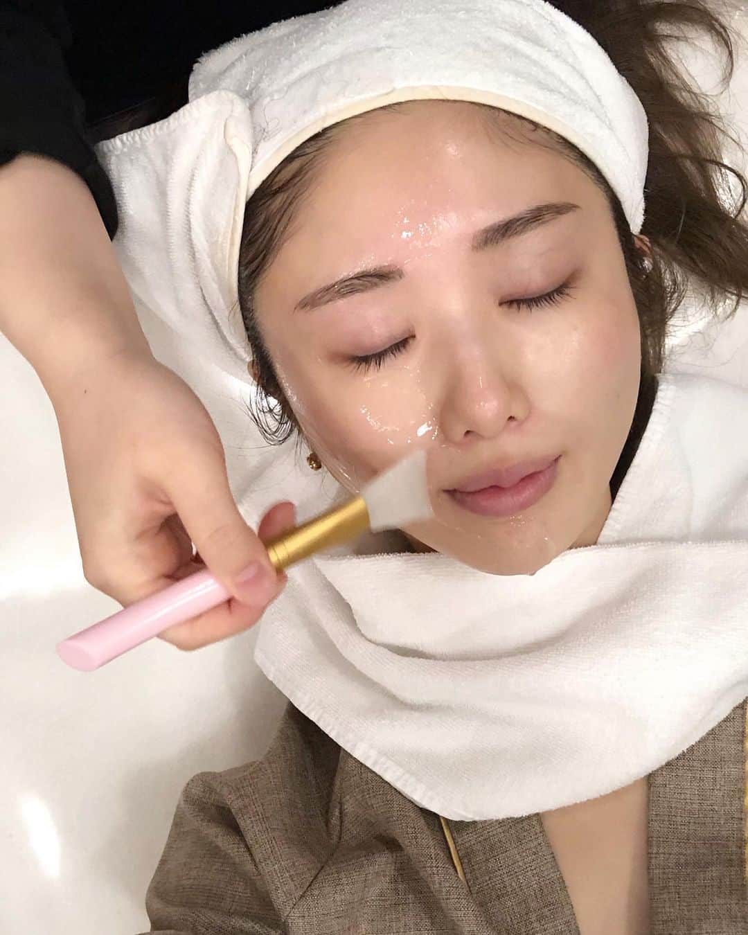 一木美里さんのインスタグラム写真 - (一木美里Instagram)「韓国皮膚科 @toxnfill35jp レポートUPしました🥀✨﻿ プロフィールのリンクから読めます✔️﻿ ①シュリンクについて﻿ ②皮膚管理について 😋✨﻿ ﻿ ちょうど1か月経って効き目が1番出る頃！なので真顔で撮ってみました📸笑﻿ 日本語も通じるし、LINEで予約できて、先生もスタッフさんもすごく自然な綺麗な方達なので説得力も安心感もあってオススメ❤️﻿ ﻿ また日常が戻って韓国へも行けるようになったら行きたいです☺️﻿ ﻿ #MillyKorea#skincare#beauty#韓国皮膚科#韓国旅行#シュリンク#モデリングマスク#ピーリング#美容#美容レーザー#明洞﻿ ﻿」3月7日 19時56分 - misato_ichiki