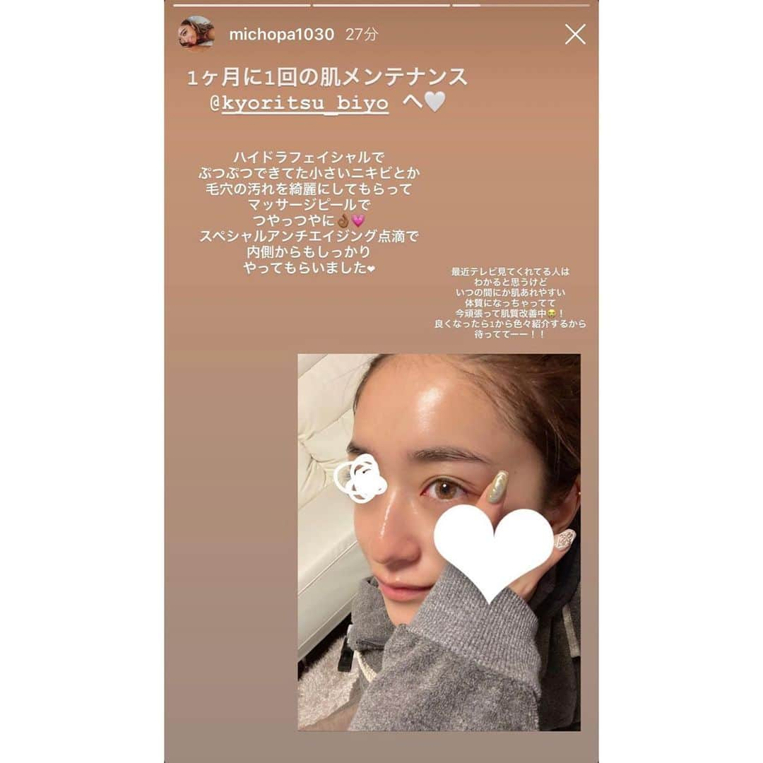 共立美容外科・歯科・皮膚科さんのインスタグラム写真 - (共立美容外科・歯科・皮膚科Instagram)「ありがとうございました😊✨ またお待ちしてます🌼 @michopa1030 ・ #共立美容外科 #渋谷院 #芸能人御用達 #みちょぱ #池田美優 #モデル #タレント #ハイドラフェイシャル #美肌 #毛穴洗浄 #ニキビケア #ニキビ跡ケア #にきびケア #にきび治療 #毛穴の汚れ #毛穴の黒ずみ #毛穴ケア #皮脂ケア #角栓除去 #美容 #肌荒れ改善  #マッサージピール #prxt33 #ストロボ肌 #たまご肌 #ツルピカ #ピーリング #アンチエイジング点滴 #美容点滴 #美容注射」3月9日 16時24分 - kyoritsu_biyo