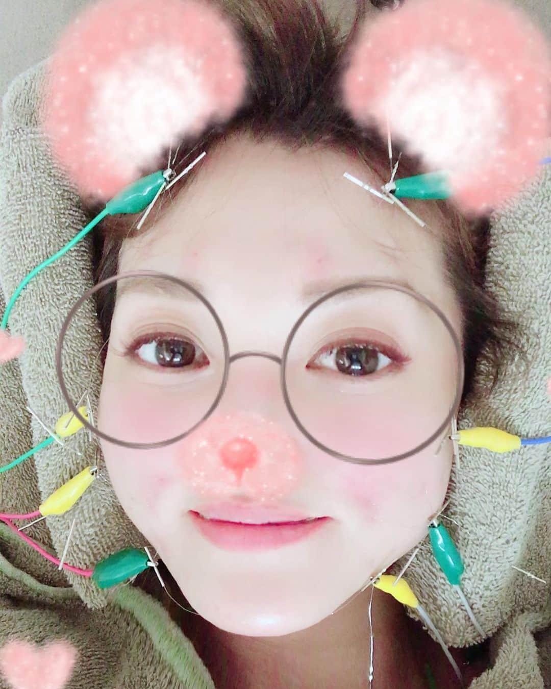 可愛ゆりあさんのインスタグラム写真 - (可愛ゆりあInstagram)「今日もハリッチで美容鍼✨  首、肩のこりやばくて、不要な血がたくさん🩸😅 そのおかげで、首、肩スッキリ&小顔に😊✨ #美容鍼　#美容　#美容垢  #美肌　#美肌ケア #小顔  #小顔美人  #小顔効果  #ハリッチ  #ハリッチ表参道 #銀座ハリッチ表参道店 #HARRICHI」3月9日 23時06分 - smilrina.love