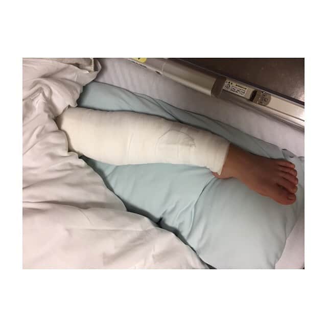 板橋美波のインスタグラム：「今日で左脚の手術をしてから1年経ちました。 最初は歩く練習から初めて、こんなんで大丈夫かな？また飛べるようになるかな？と不安だらけで、苦しい事だらけでしたが何とか試合に出れるようになるまで回復しました😊 4月のワールドカップに向けて今自分が出来る事を精一杯やりたいと思います💪  One year after surgery…😂」